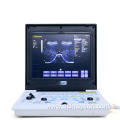 Silver Gradient Pregnancy Ultrasound Diagnostic Equipment